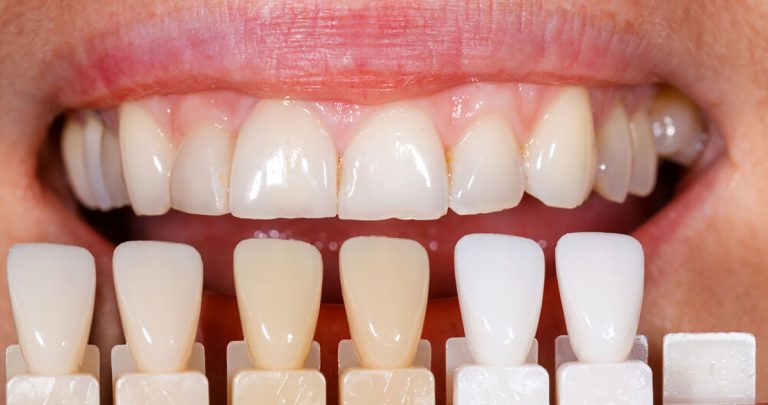 تصویر امینیت کامپوزیت